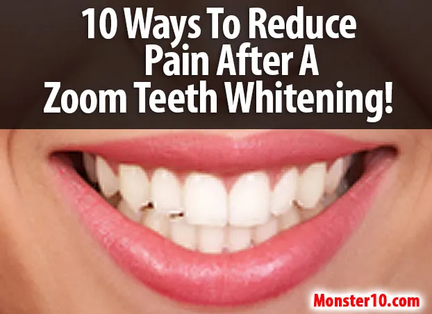 28912 zoom teeth whitening procedure