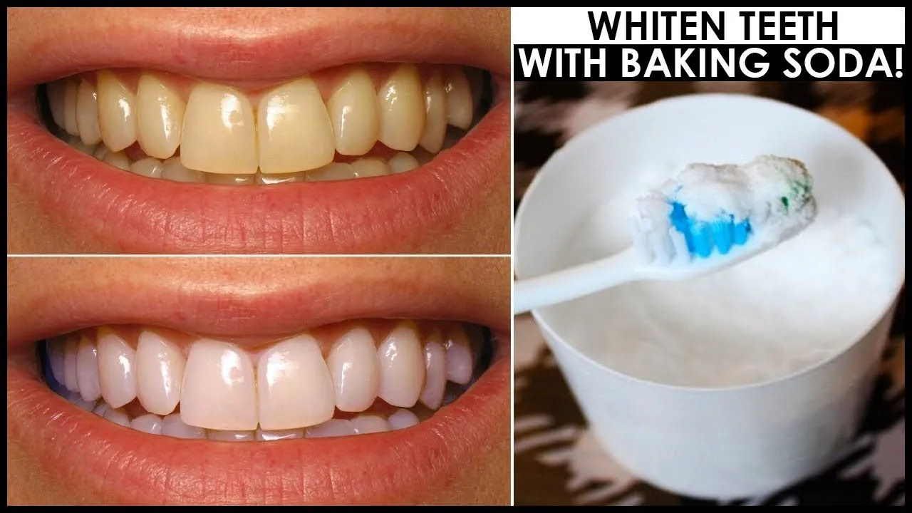 /img/28916-alternative-teeth-whitening.webp
