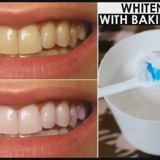 /img/28916-alternative-teeth-whitening.webp