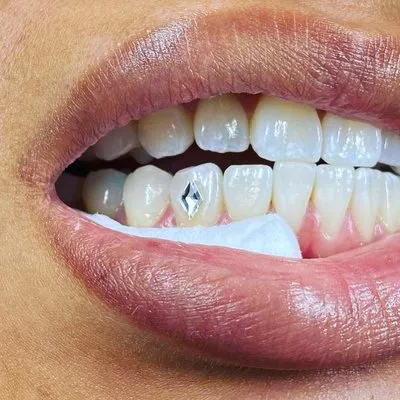 28920 teeth whitening oral health