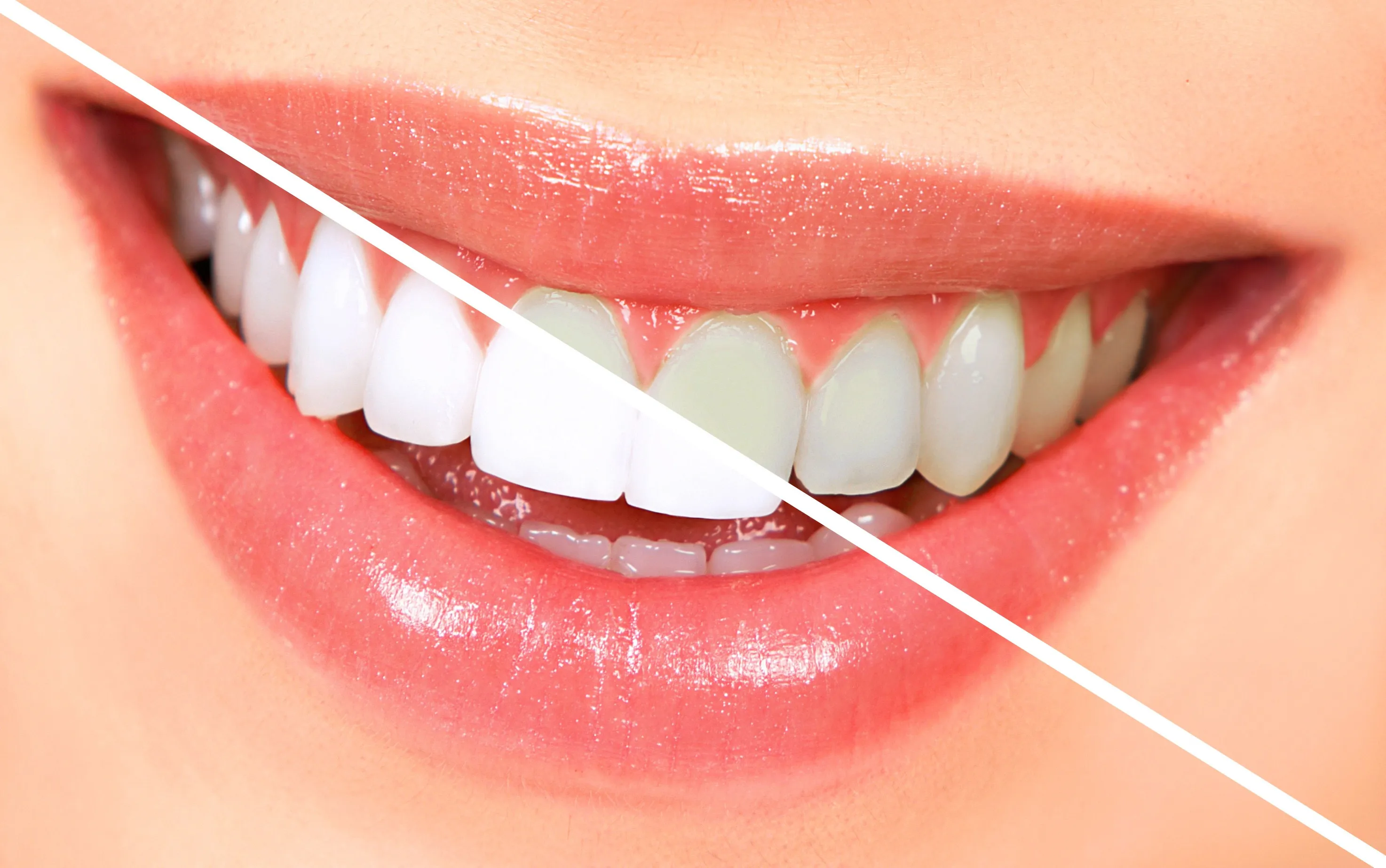 28922 bright smile tips