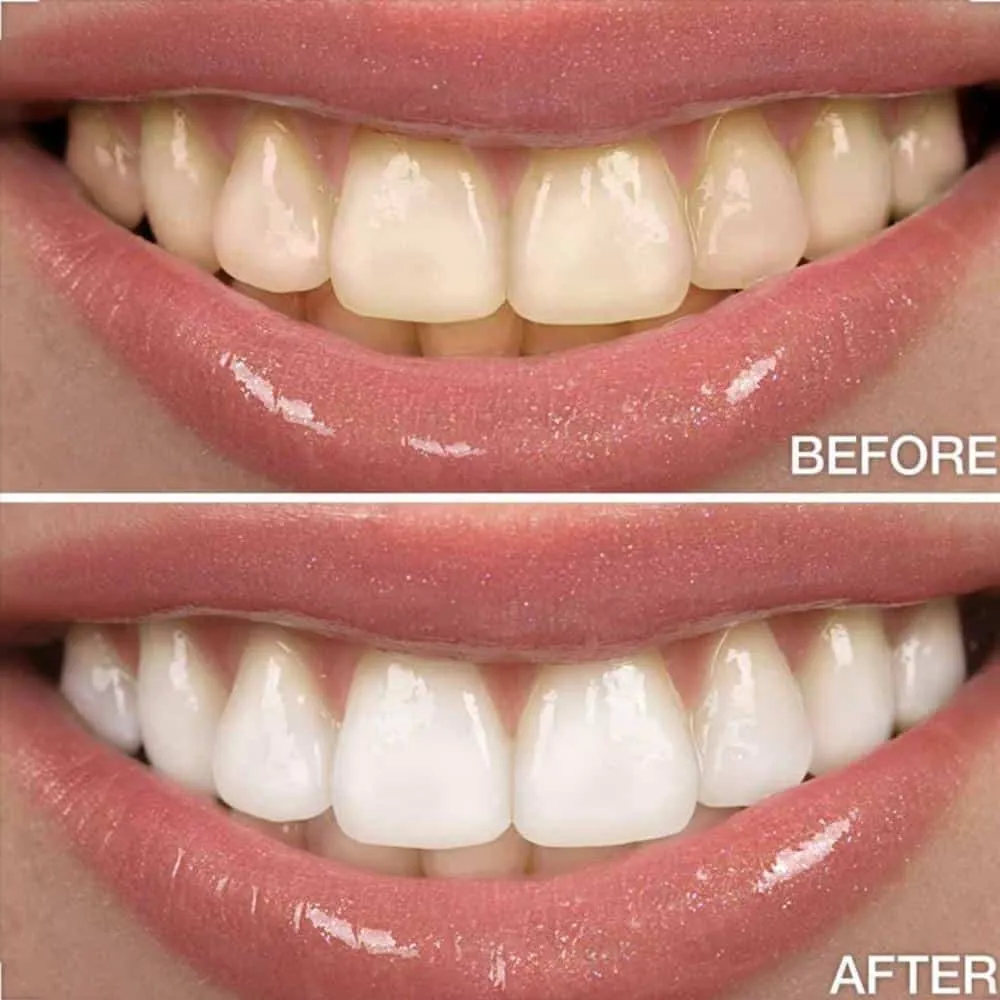 28922 teeth whitening ingredients