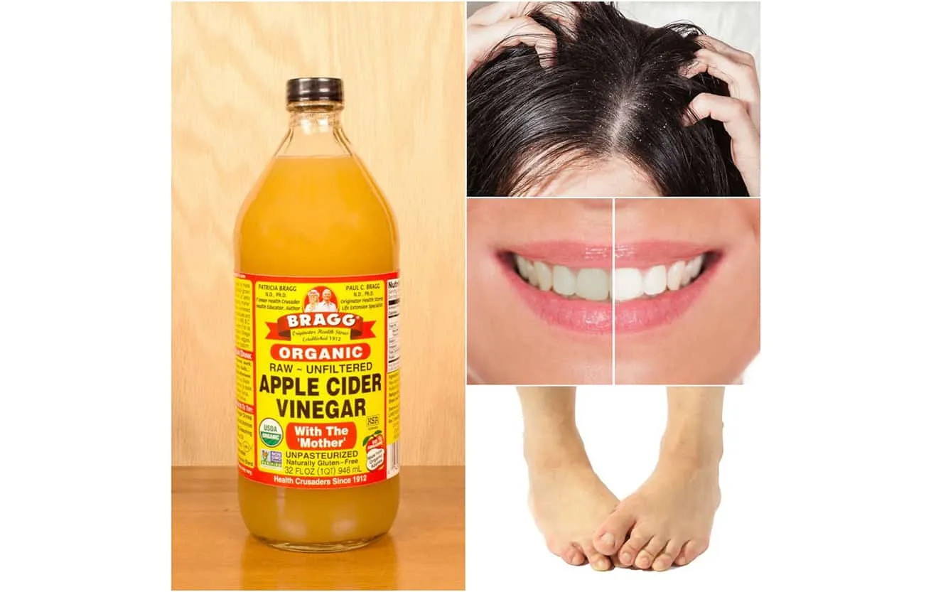 28926 applying baking soda acv underarms