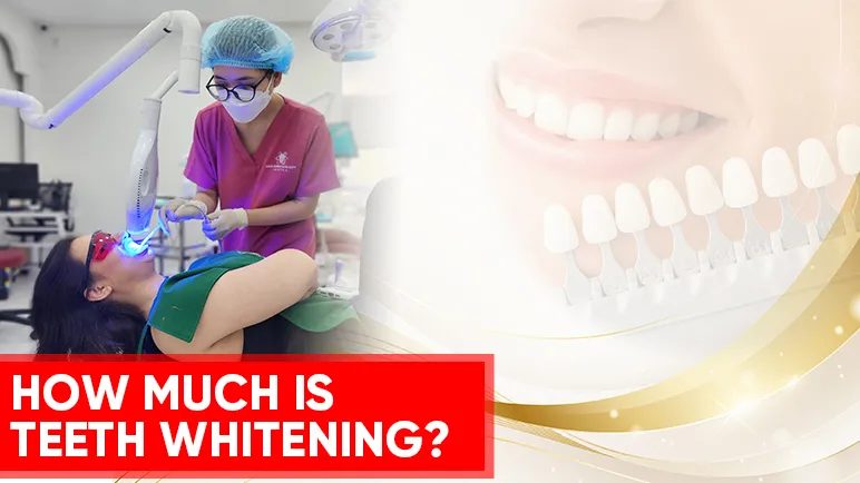 28929 teeth whitening geographic