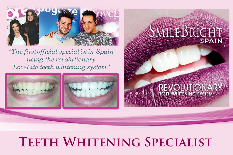 28936 teeth whitening spain clinic1