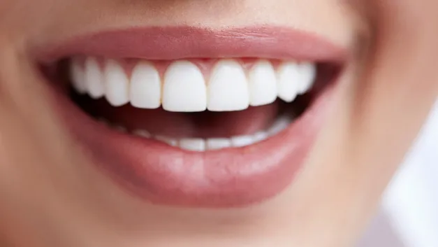 28936 teeth whitening spain clinic3