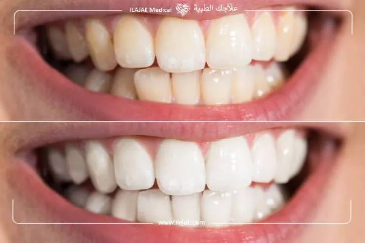 28939 teeth whitening location