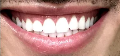 28943 beaverton dentist consultation