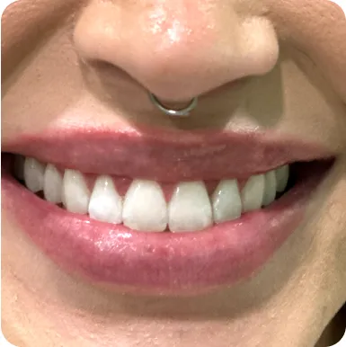 28943 proper oral hygiene