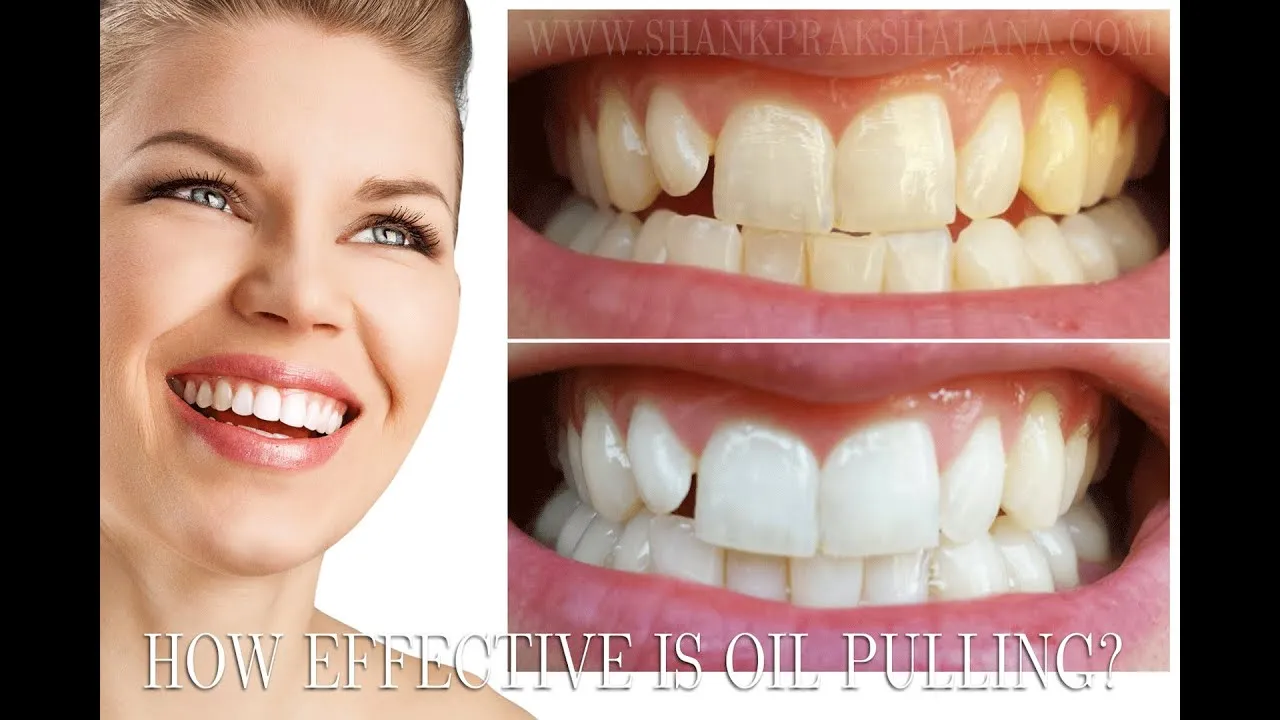 28944 oil pulling teeth whitening image3