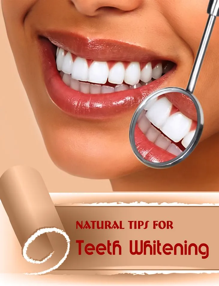 28945 teeth whitening results