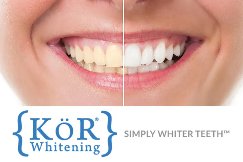 28946 kor teeth whitening procedure