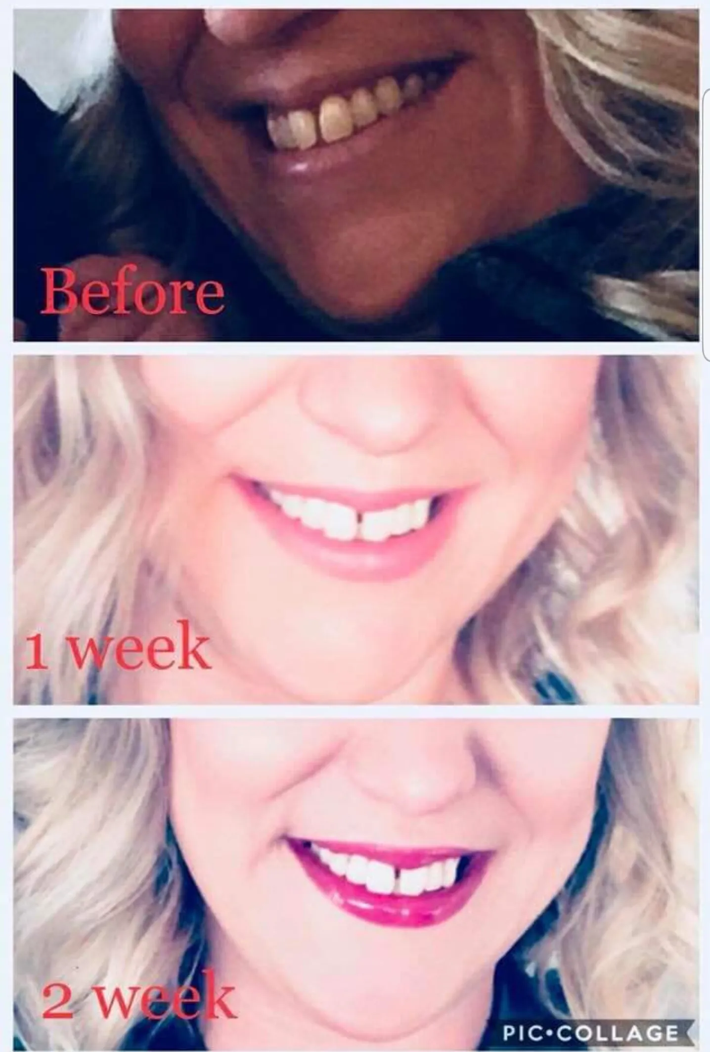 28950 baking soda hydrogen peroxide