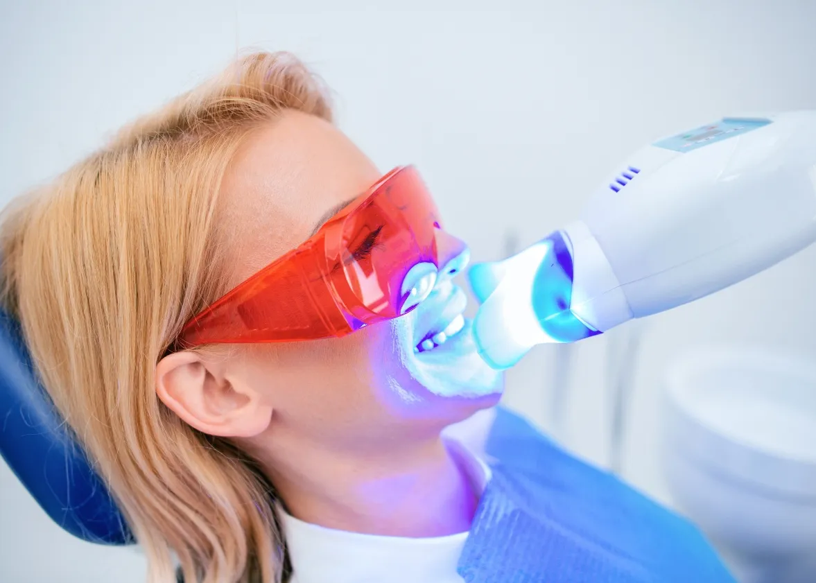 28951 teeth whitening palm coast cost effective