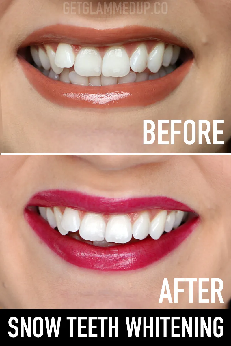 28952 compelling facebook page snow teeth whitening