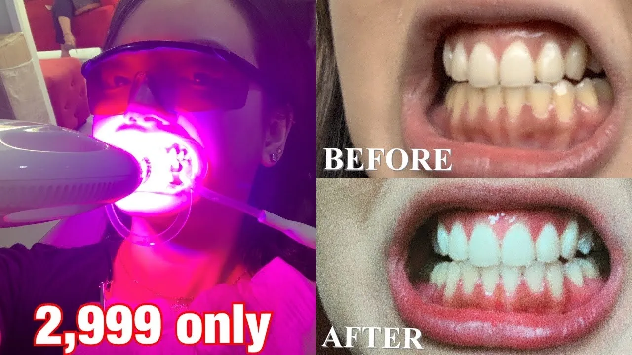 28962 avoiding stains