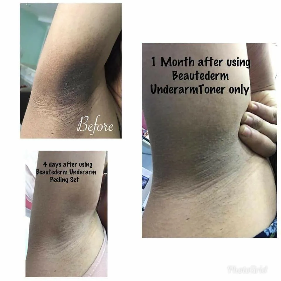 28971 exfoliation techniques