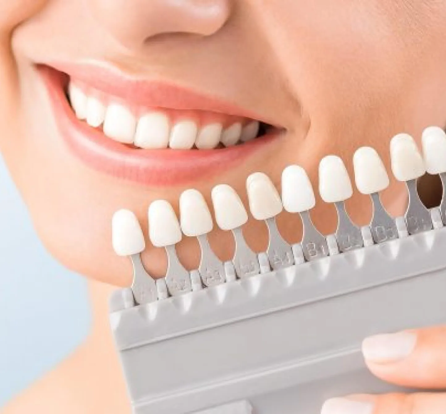 28972 teeth whitening treatment