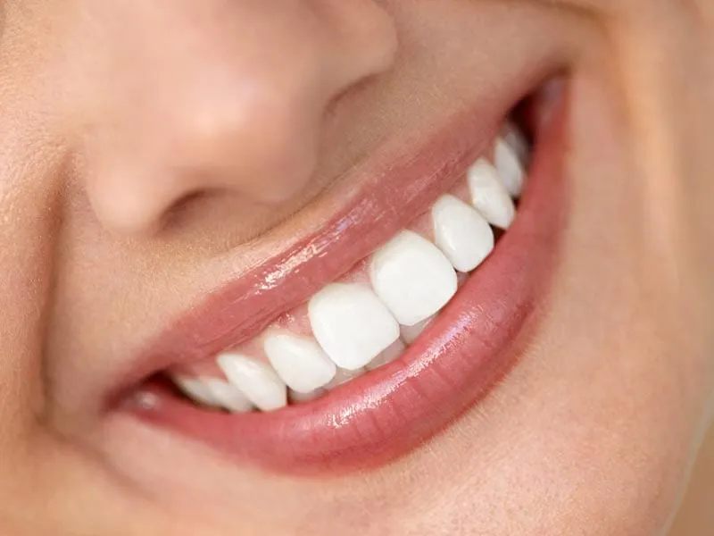 28978 teeth whitening bend or dentist