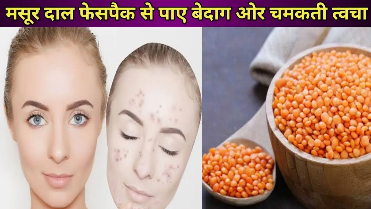 28979 masoor dal yogurt