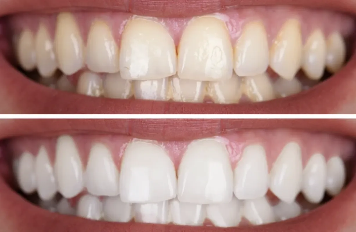 28980 healthy foods for teeth