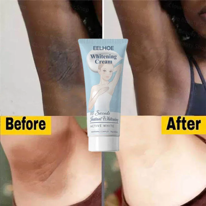/img/28987-lifestyle-changes-armpit.webp