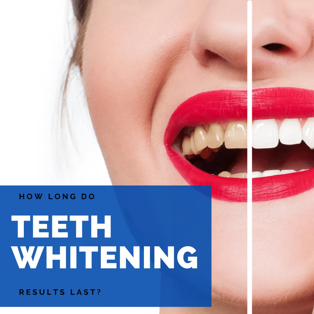 28989 oral hygiene teeth