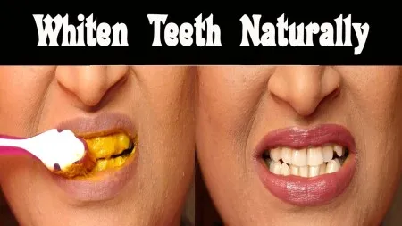 28990 turmeric teeth whitening image2