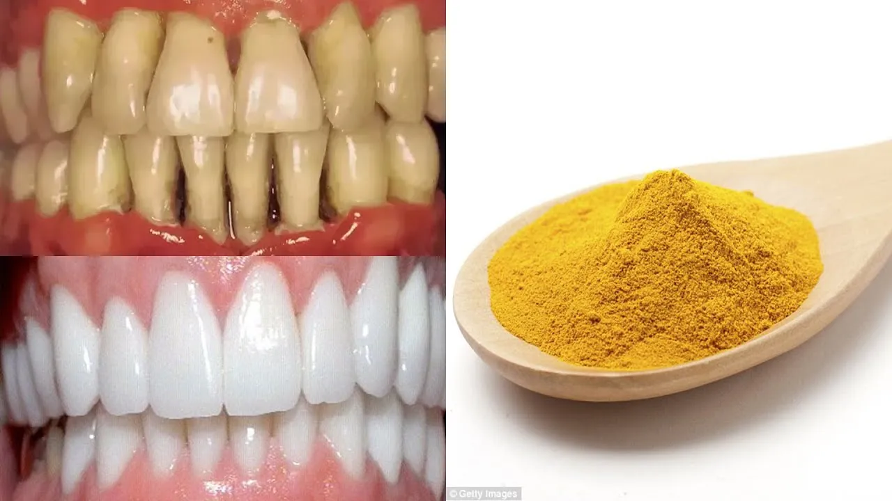 28990 turmeric teeth whitening image3