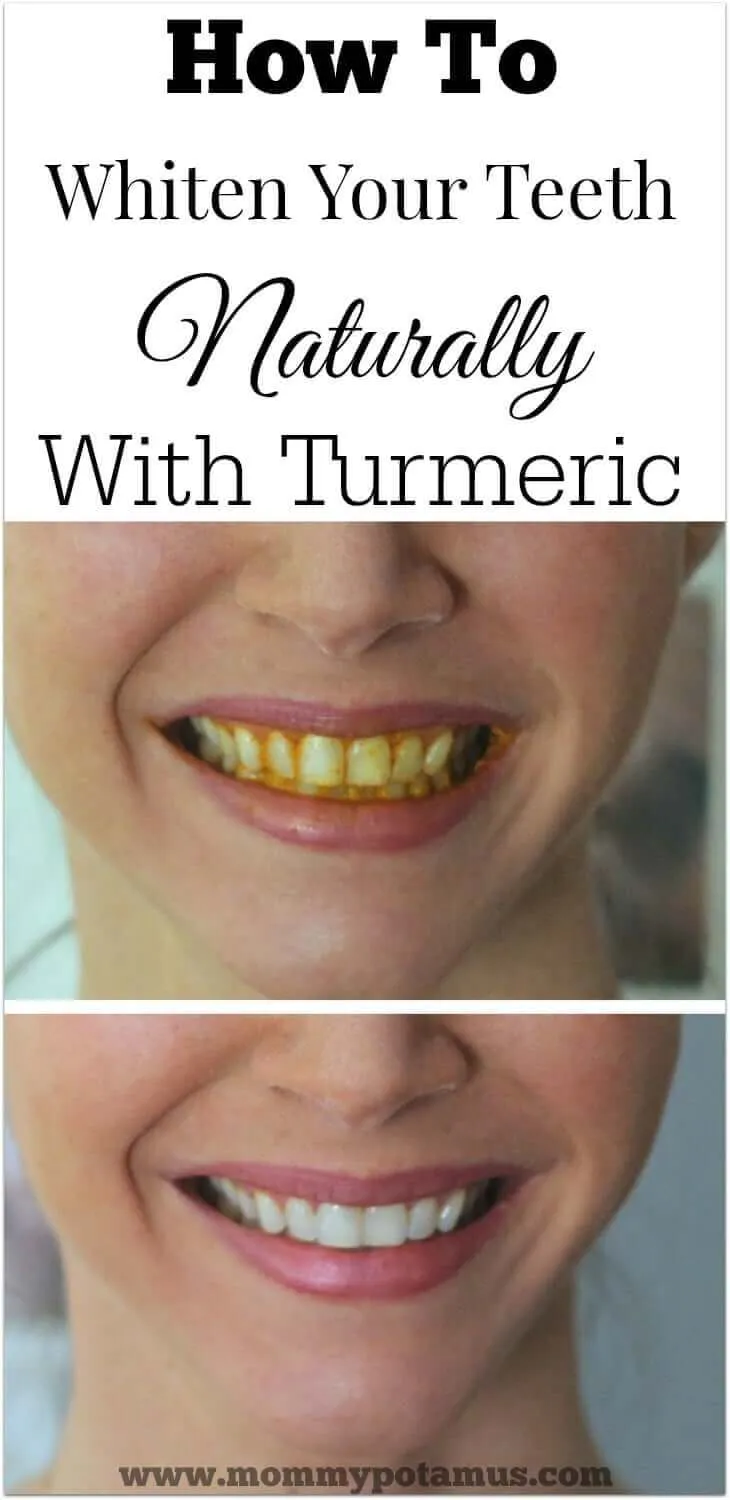 28990 turmeric teeth whitening image4