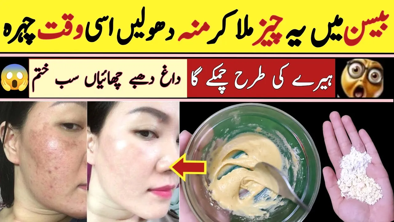 28996 besan flour honey mask