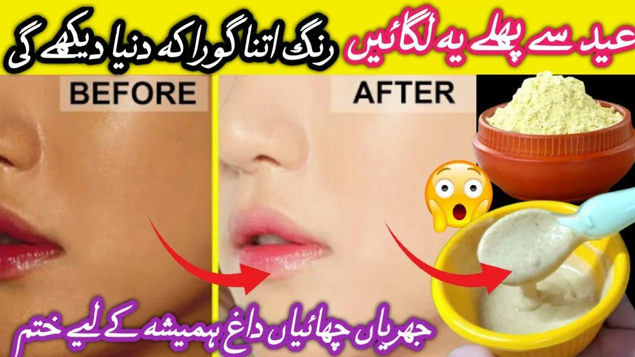 28996 hyperpigmentation skin