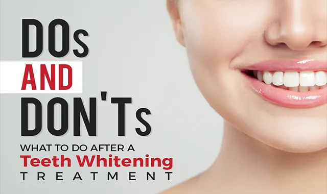 28998 at home teeth whitening