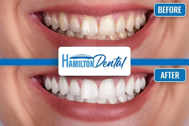 28999 smiling teeth hamilton