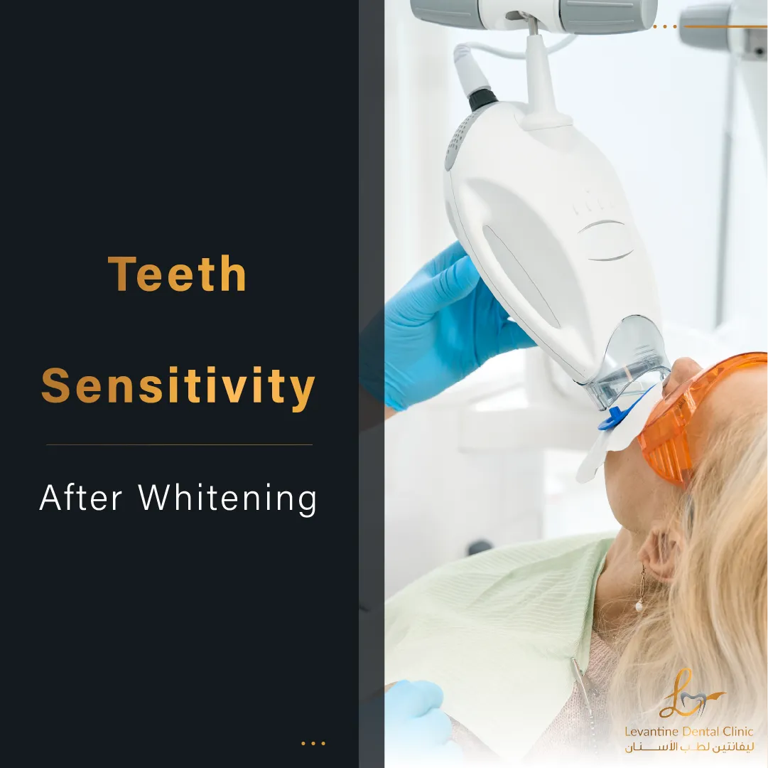 /img/29006-post-whitening-care.webp