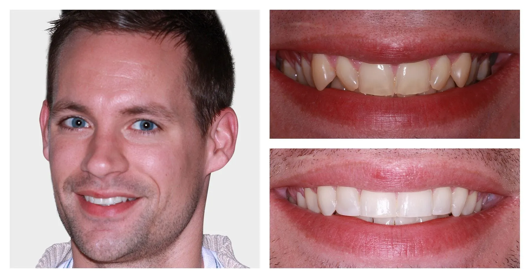 29010 whitening toothpastes rinses