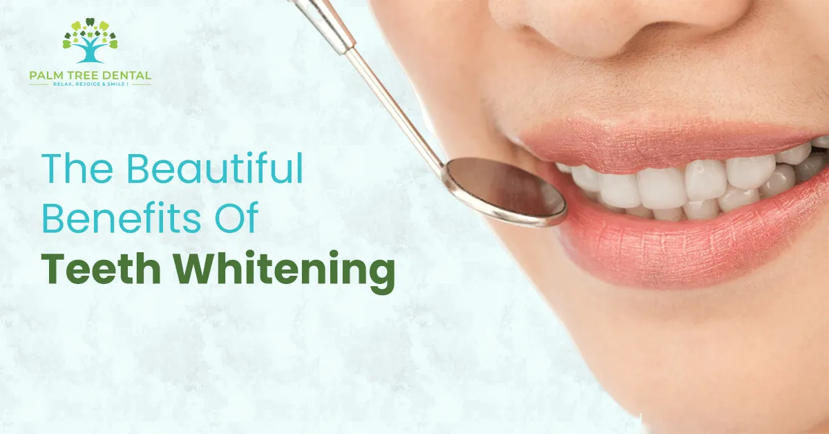 /img/29013-lasting-teeth-whitening.webp