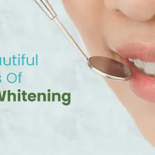 /img/29013-lasting-teeth-whitening.webp