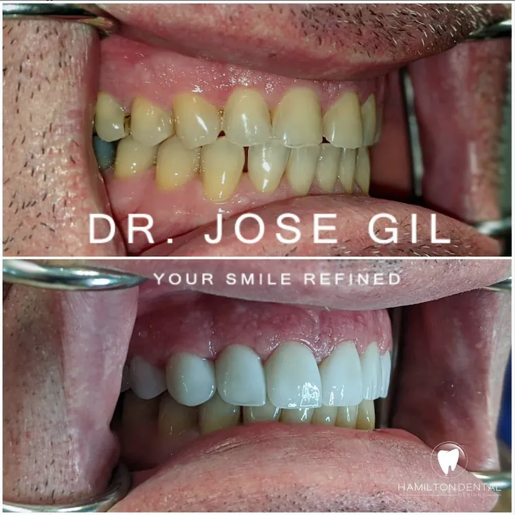 29015 teeth whitening allentown pa 6