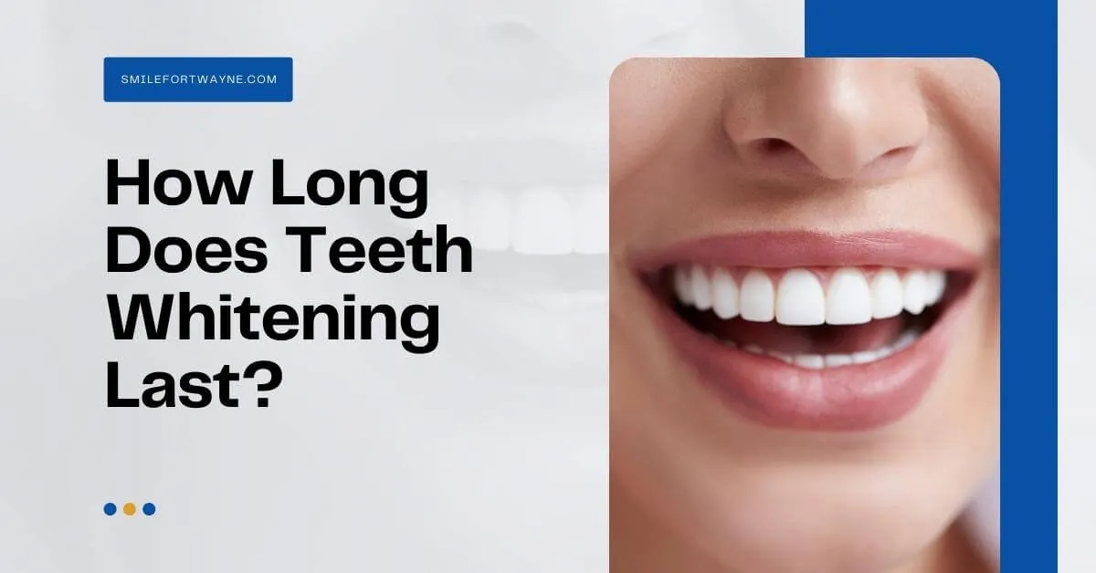 29016 teeth whitening fort wayne 3