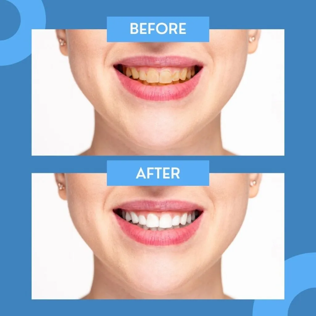 29017 good oral hygiene