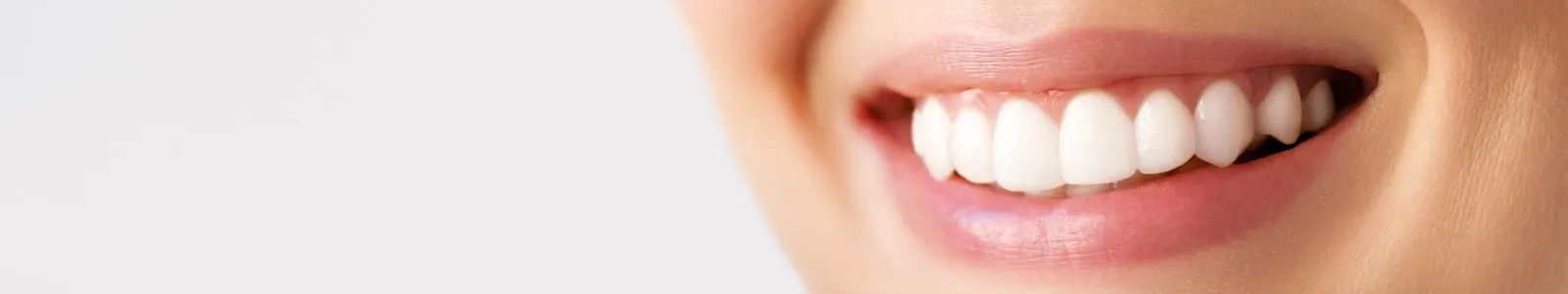 29024 bright smile confidence