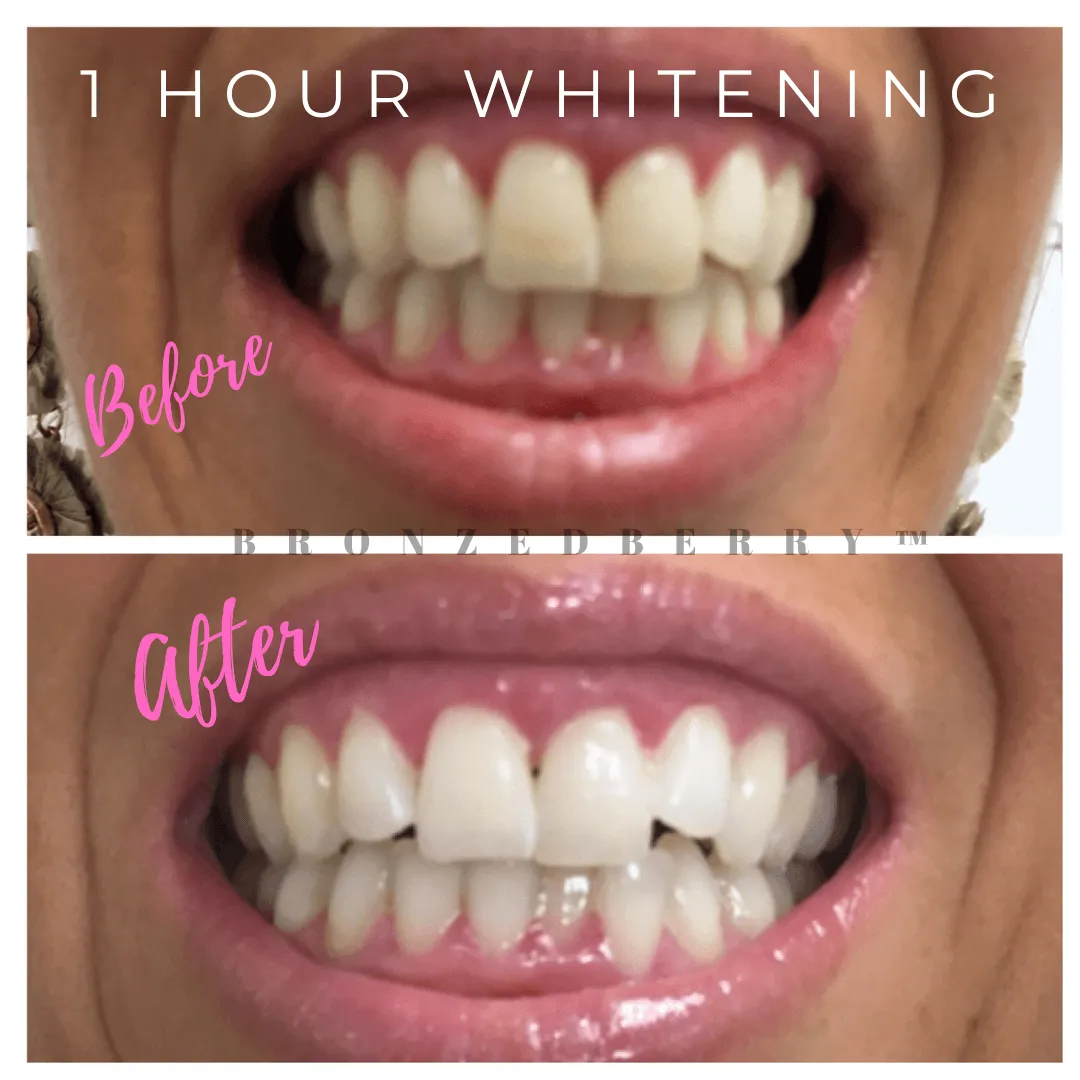 29025 whitening application